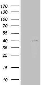 TOMM40L Antibody in Western Blot (WB)