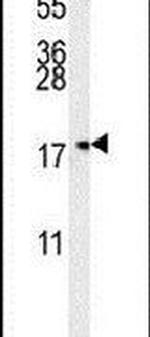 TOMM6 Antibody in Western Blot (WB)