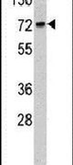 TOM70 Antibody in Western Blot (WB)