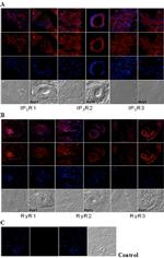 Ryanodine Receptor Antibody in Immunohistochemistry (IHC)