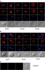 Ryanodine Receptor Antibody in Immunocytochemistry (ICC/IF)