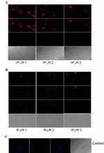 RyR1 Antibody in Immunohistochemistry, Immunocytochemistry (IHC, ICC/IF)