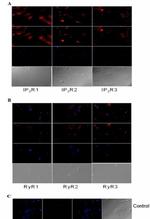 Ryanodine Receptor Antibody in Immunocytochemistry (ICC/IF)