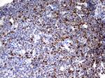 TOP2A Antibody in Immunohistochemistry (Paraffin) (IHC (P))