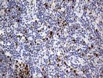 TOP2A Antibody in Immunohistochemistry (Paraffin) (IHC (P))