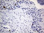 TOP2A Antibody in Immunohistochemistry (Paraffin) (IHC (P))