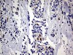 TOP2A Antibody in Immunohistochemistry (Paraffin) (IHC (P))