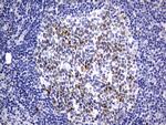 TOP2A Antibody in Immunohistochemistry (Paraffin) (IHC (P))