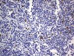 TOP2A Antibody in Immunohistochemistry (Paraffin) (IHC (P))