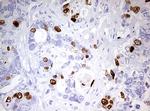TOP2A Antibody in Immunohistochemistry (Paraffin) (IHC (P))