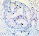 TOP2A Antibody in Immunohistochemistry (Paraffin) (IHC (P))