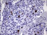 TOP2A Antibody in Immunohistochemistry (Paraffin) (IHC (P))
