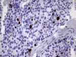 TOP2A Antibody in Immunohistochemistry (Paraffin) (IHC (P))