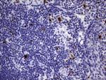TOP2A Antibody in Immunohistochemistry (Paraffin) (IHC (P))