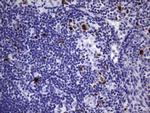 TOP2A Antibody in Immunohistochemistry (Paraffin) (IHC (P))
