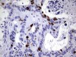 TOP2A Antibody in Immunohistochemistry (Paraffin) (IHC (P))
