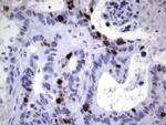 TOP2A Antibody in Immunohistochemistry (Paraffin) (IHC (P))
