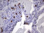 TOP2A Antibody in Immunohistochemistry (Paraffin) (IHC (P))