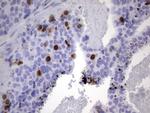 TOP2A Antibody in Immunohistochemistry (Paraffin) (IHC (P))