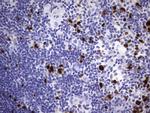 TOP2A Antibody in Immunohistochemistry (Paraffin) (IHC (P))