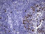 TOP2A Antibody in Immunohistochemistry (Paraffin) (IHC (P))