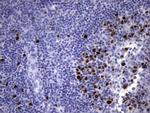 TOP2A Antibody in Immunohistochemistry (Paraffin) (IHC (P))