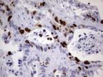 TOP2A Antibody in Immunohistochemistry (Paraffin) (IHC (P))