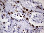 TOP2A Antibody in Immunohistochemistry (Paraffin) (IHC (P))