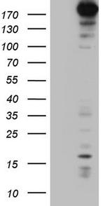 TOP2A Antibody in Western Blot (WB)