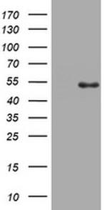 TOP2A Antibody in Western Blot (WB)