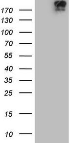 TOP2A Antibody in Western Blot (WB)