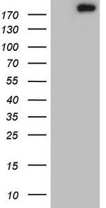 TOP2A Antibody in Western Blot (WB)