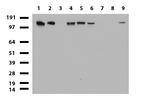 TOP2A Antibody in Western Blot (WB)
