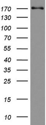 TOP2A Antibody in Western Blot (WB)