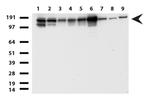 TOP2A Antibody in Western Blot (WB)