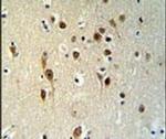TOX3 Antibody in Immunohistochemistry (IHC)