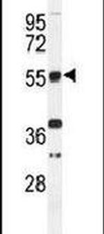 TOX3 Antibody in Western Blot (WB)