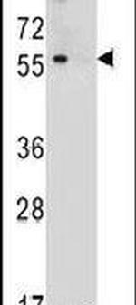 TOX3 Antibody in Western Blot (WB)