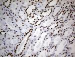 TP53BP1 Antibody in Immunohistochemistry (Paraffin) (IHC (P))