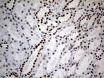 TP53BP1 Antibody in Immunohistochemistry (Paraffin) (IHC (P))