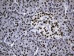 TP53BP1 Antibody in Immunohistochemistry (Paraffin) (IHC (P))