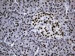 TP53BP1 Antibody in Immunohistochemistry (Paraffin) (IHC (P))
