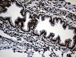 TP53BP1 Antibody in Immunohistochemistry (Paraffin) (IHC (P))