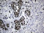 TP53BP1 Antibody in Immunohistochemistry (Paraffin) (IHC (P))