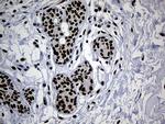 TP53BP1 Antibody in Immunohistochemistry (Paraffin) (IHC (P))