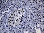 TP53BP1 Antibody in Immunohistochemistry (Paraffin) (IHC (P))