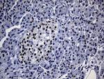 TP53BP1 Antibody in Immunohistochemistry (Paraffin) (IHC (P))