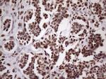 TP53BP1 Antibody in Immunohistochemistry (Paraffin) (IHC (P))