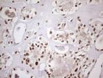 TP53BP1 Antibody in Immunohistochemistry (Paraffin) (IHC (P))