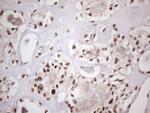 TP53BP1 Antibody in Immunohistochemistry (Paraffin) (IHC (P))